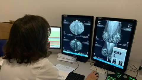 Un estudio refuerza un fármaco contra el cáncer de mama metastásico que actúa como un caballo de Troya