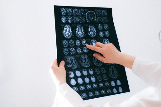 Daño cerebral adquirido Daño cerebral adquirido