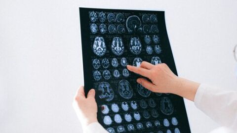Daño cerebral adquirido Daño cerebral adquirido
