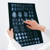 Daño cerebral adquirido Daño cerebral adquirido