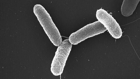 Imagen al microscopio de Salmonella enterica serovar Typhimurium.