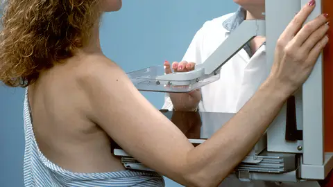 Las mamografías pueden detectar cáncer de mama en estadios iniciales Las mamografías pueden detectar cáncer de mama en estadios iniciales