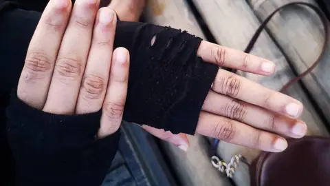 El fenómeno de Raynaud: cuando los dedos cambian de color por culpa del frío El fenómeno de Raynaud: cuando los dedos cambian de color por culpa del frío