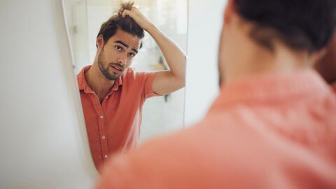 Alopecia Alopecia