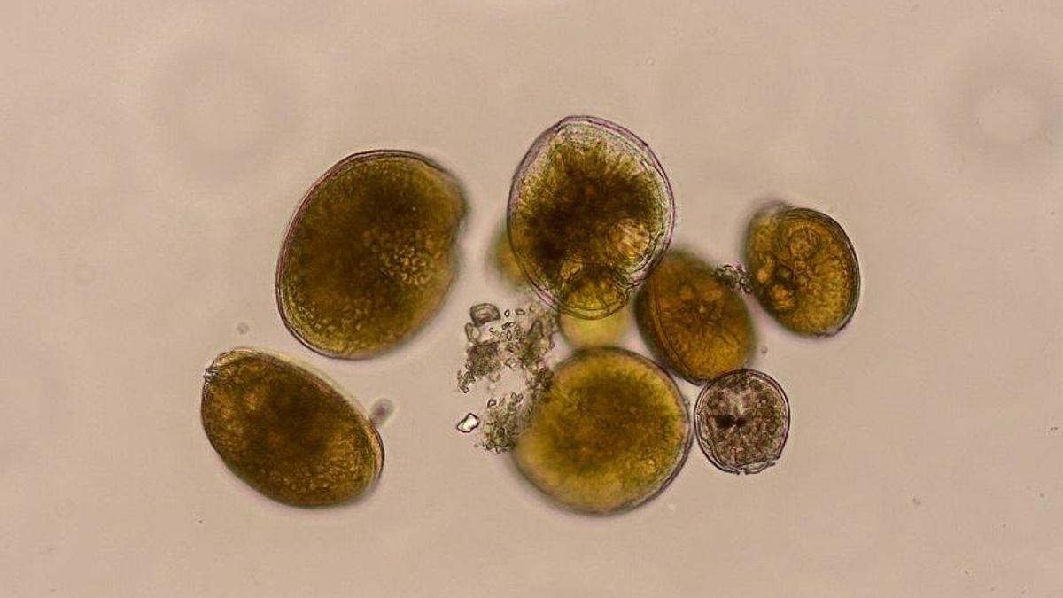 Detectan por primera vez microalgas tóxicas que infectan el pescado del Mediterráneo Detectan por primera vez microalgas tóxicas que infectan el pescado del Mediterráneo