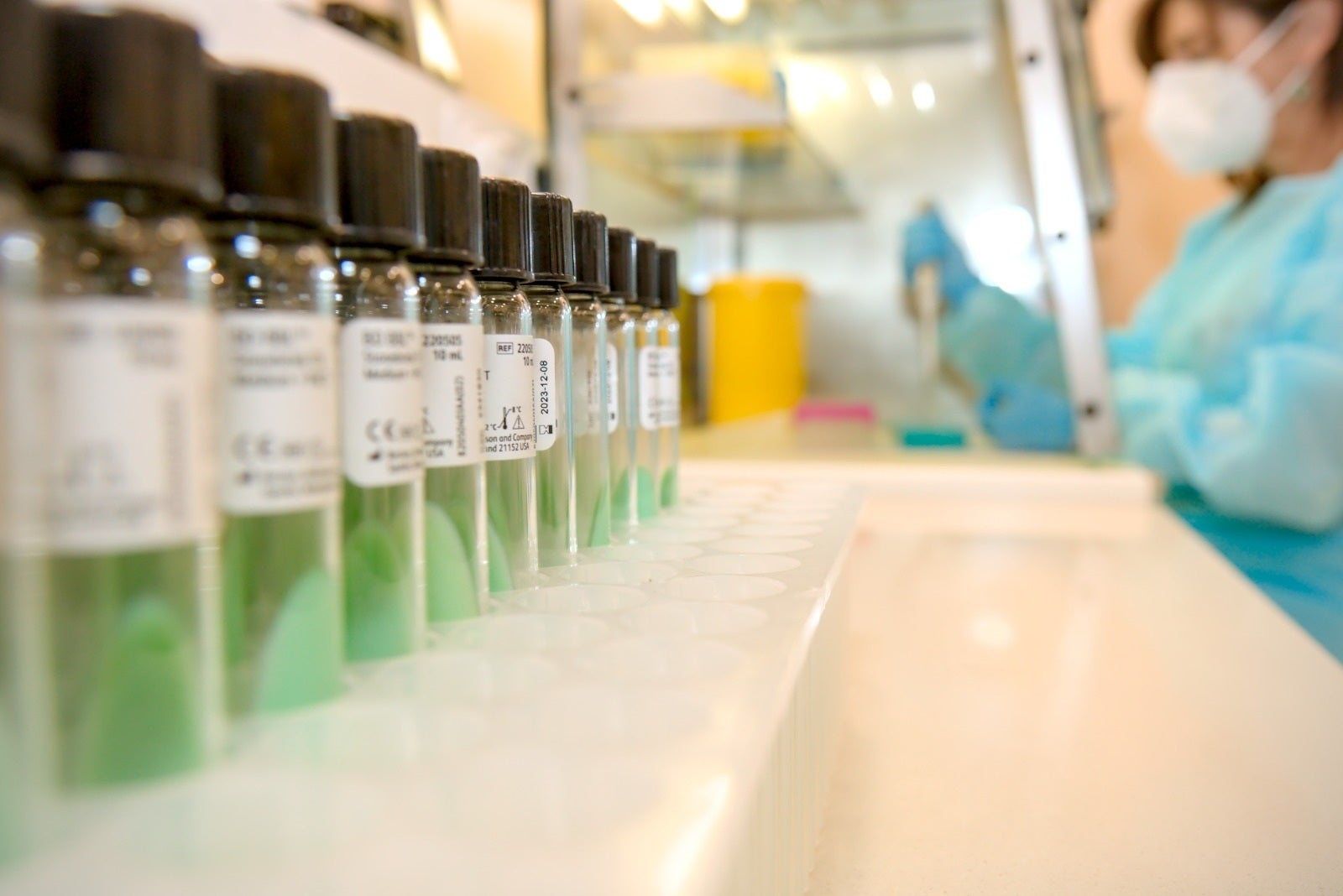 "Es una enfermedad tremendamente infecciosa": un experto advierte de la presencia de sarampión en España "Es una enfermedad tremendamente infecciosa": un experto advierte de la presencia de sarampión en España