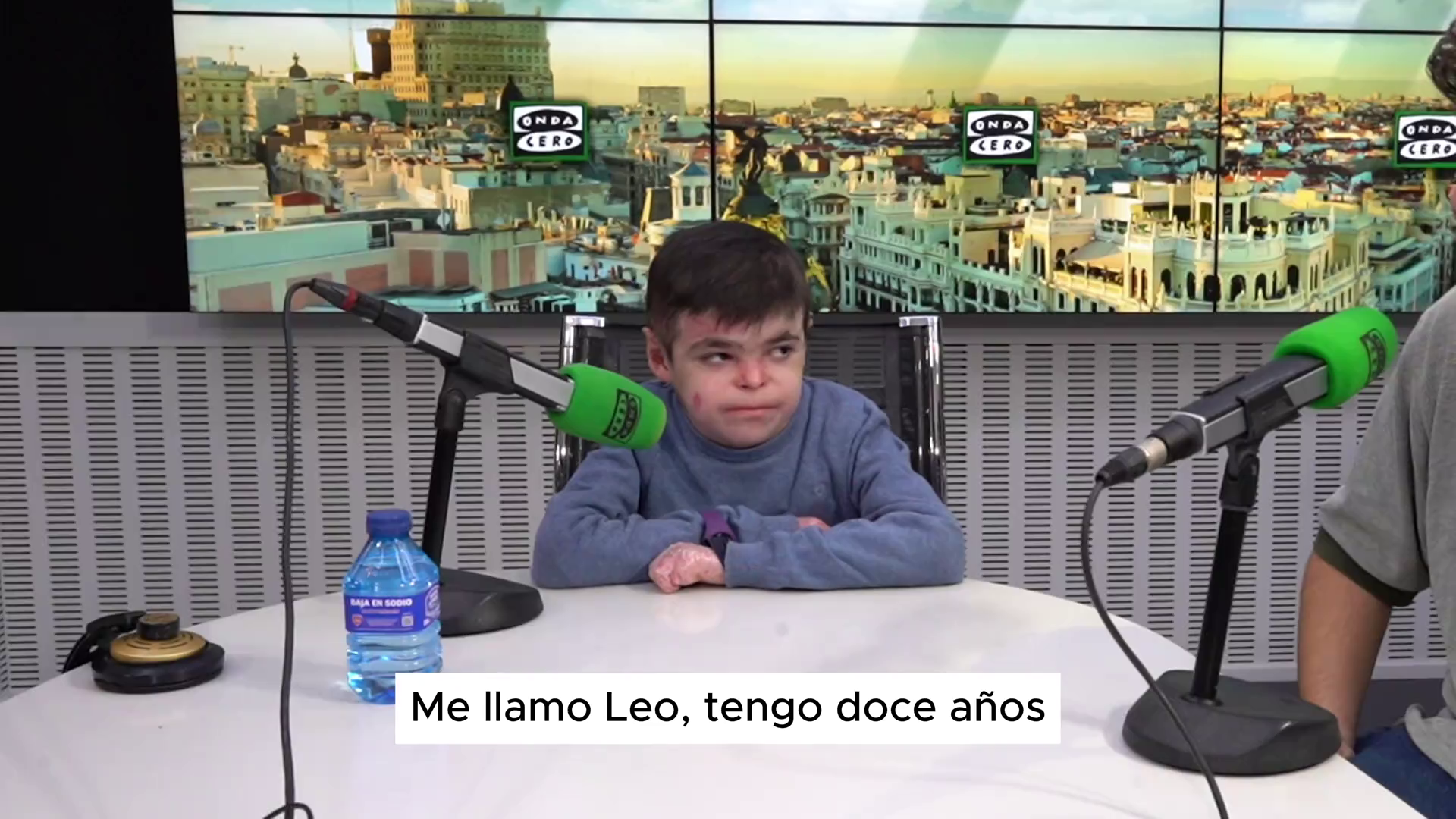 La historia de Leo, niño con la enfermedad de 'piel de mariposa': "Tengo un dolor que nunca se va" La historia de Leo, niño con la enfermedad de 'piel de mariposa': "Tengo un dolor que nunca se va"