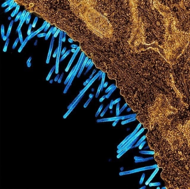 Micrografía electrónica de transmisión coloreada que muestra las partículas del virus de la gripe porcina (azul) unidas a una célula (naranja). Micrografía electrónica de transmisión coloreada que muestra las partículas del virus de la gripe porcina (azul) unidas a una célula (naranja).