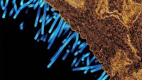 Micrograf&iacute;a electr&oacute;nica de transmisi&oacute;n coloreada que muestra las part&iacute;culas del virus de la gripe porcina (azul) unidas a una c&eacute;lula (naranja).