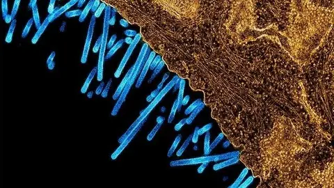 Micrografía electrónica de transmisión coloreada que muestra las partículas del virus de la gripe porcina (azul) unidas a una célula (naranja). Micrografía electrónica de transmisión coloreada que muestra las partículas del virus de la gripe porcina (azul) unidas a una célula (naranja).