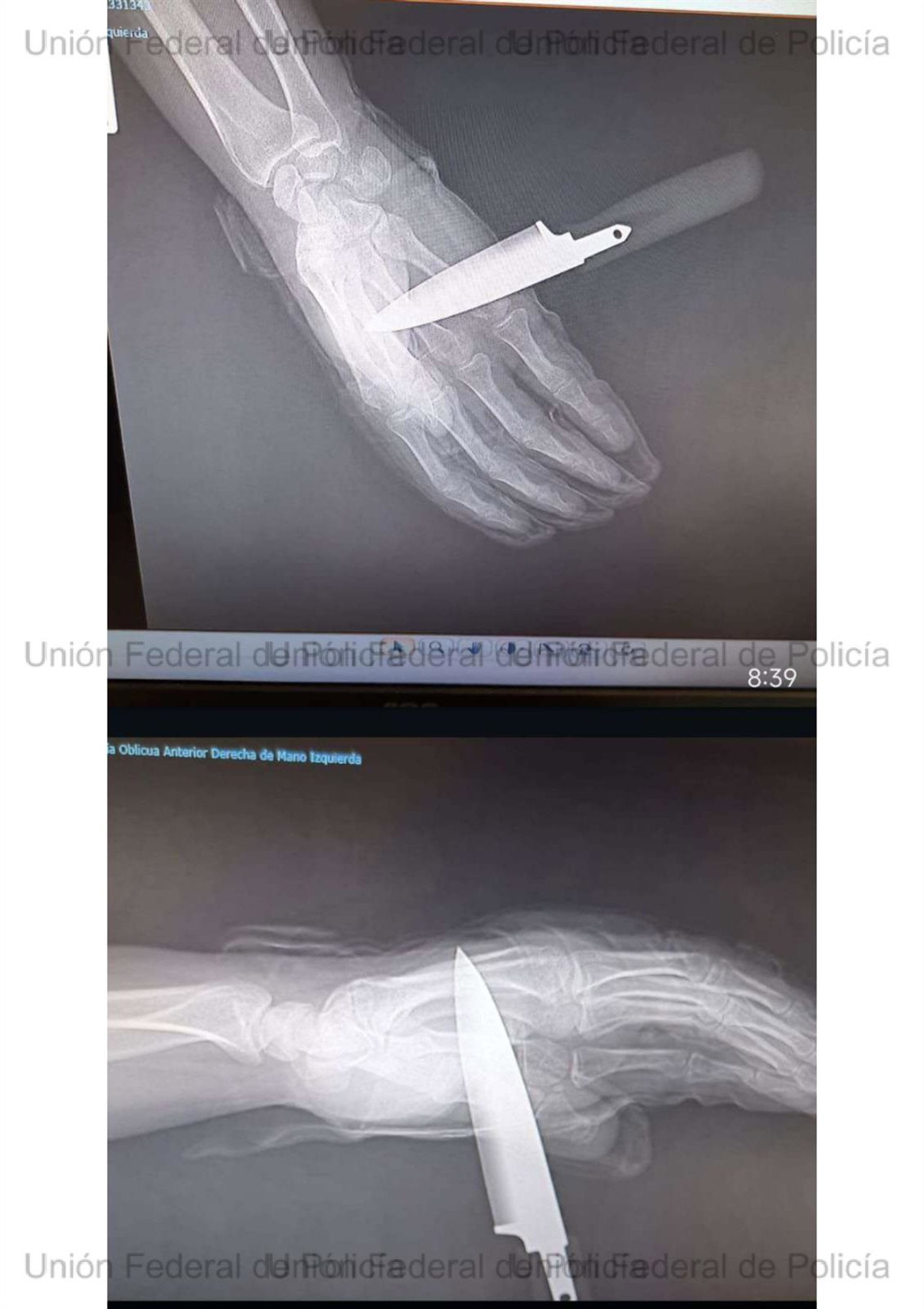 Un agente de la Policía Nacional, apuñalado en Baza durante una intervención familiar Un agente de la Policía Nacional, apuñalado en Baza durante una intervención familiar