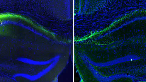 Imagen de microscopía de los hipocampos del ratón. Imagen de microscopía de los hipocampos del ratón.