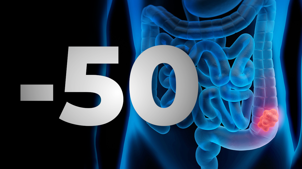 Per què augmenta el càncer colorectal? El Vall d'Hebrón en té les claus Per què augmenta el càncer colorectal? El Vall d'Hebrón en té les claus