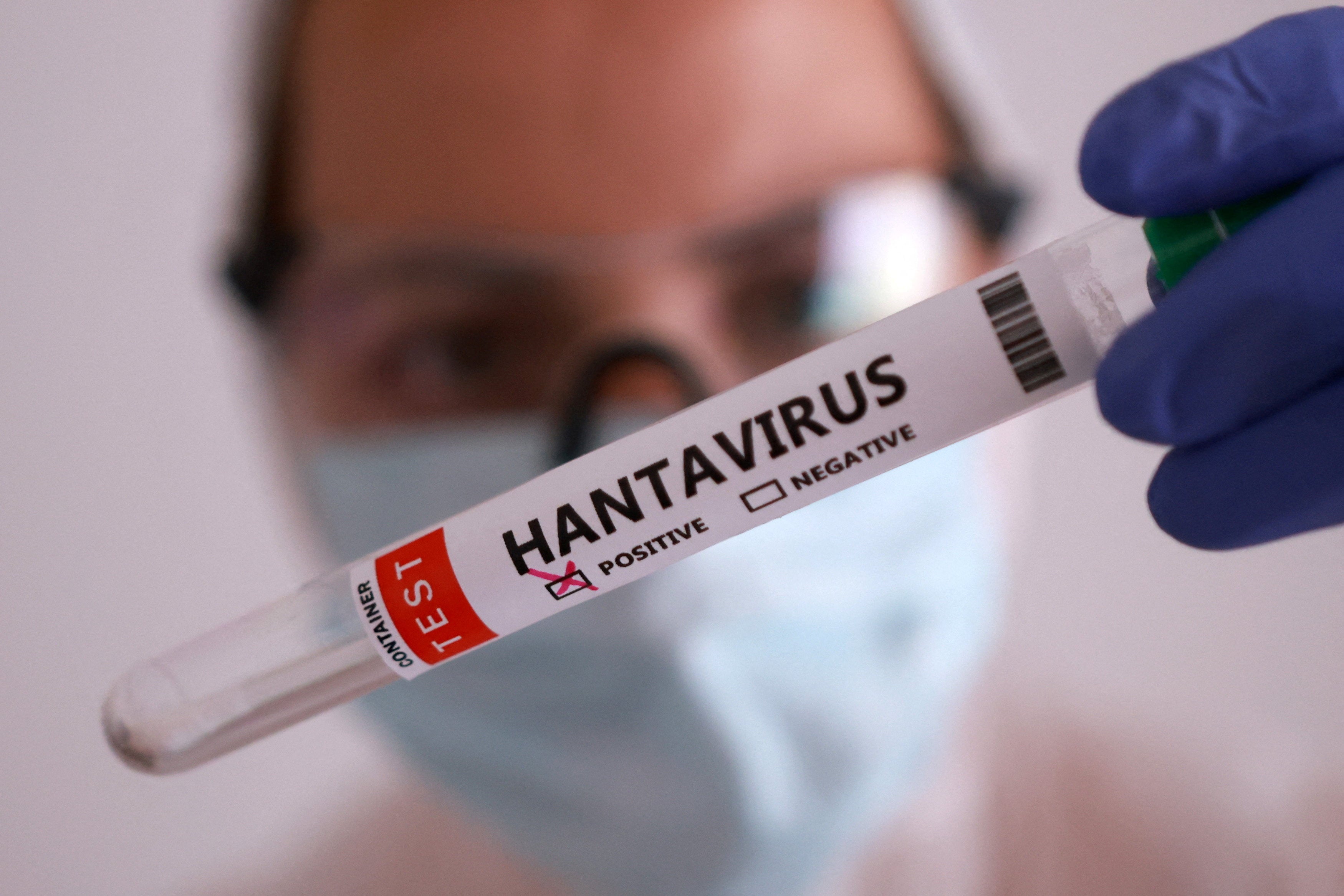 Así escapa el hantavirus al control del sistema inmunitario: cómo puede evitarse y cómo podemos protegernos Así escapa el hantavirus al control del sistema inmunitario: cómo puede evitarse y cómo podemos protegernos