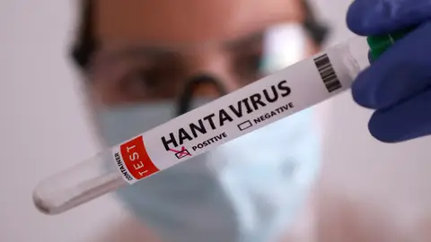 Imagen de un vial de hantavirus. Imagen de un vial de hantavirus.