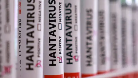 Hantavirus positivo La ilustración muestra tubos de ensayo con la etiqueta "Hantavirus positivo"./ REUTERS/Dado Ruvic/Illustration