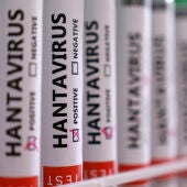 La ilustración muestra tubos de ensayo con la etiqueta "Hantavirus positivo"./ REUTERS/Dado Ruvic/Illustration