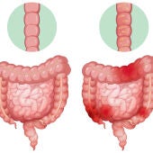 Recreación de los intestinos de una persona