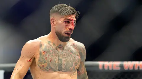 El hispano-georgiano Ilia Topuria finalizó con la cara ensangrentada en su derrota ante el estadounidense Justin Gaethje en un combate de la UFC celebrado en la Casa Blanca El español Topuria cae derrotado en el combate en la Casa Blanca del cumpleaños de Trump