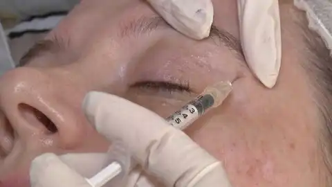 Aplicacion de Botox Aplicacion de Botox