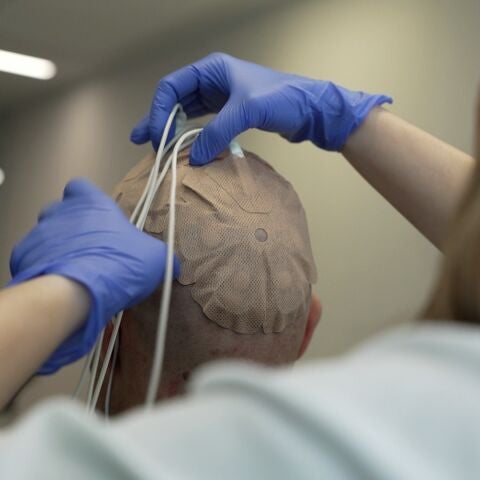 Pacientes con glioblastoma del 12 de Octubre participan en un ensayo que combina campos eléctricos e inmunoterapia