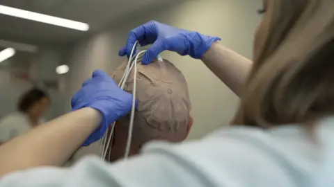 Pacientes con glioblastoma del 12 de Octubre participan en un ensayo que combina campos eléctricos e inmunoterapia Pacientes con glioblastoma del 12 de Octubre participan en un ensayo que combina campos eléctricos e inmunoterapia