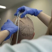 Pacientes con glioblastoma del 12 de Octubre participan en un ensayo que combina campos eléctricos e inmunoterapia Pacientes con glioblastoma del 12 de Octubre participan en un ensayo que combina campos eléctricos e inmunoterapia