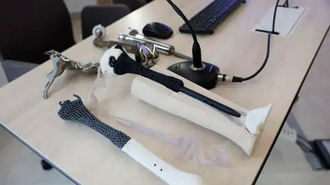 Vista de la primera prótesis personalizada en el mundo realizada con un nuevo metamaterial Vista de la primera prótesis personalizada en el mundo realizada con un nuevo metamaterial