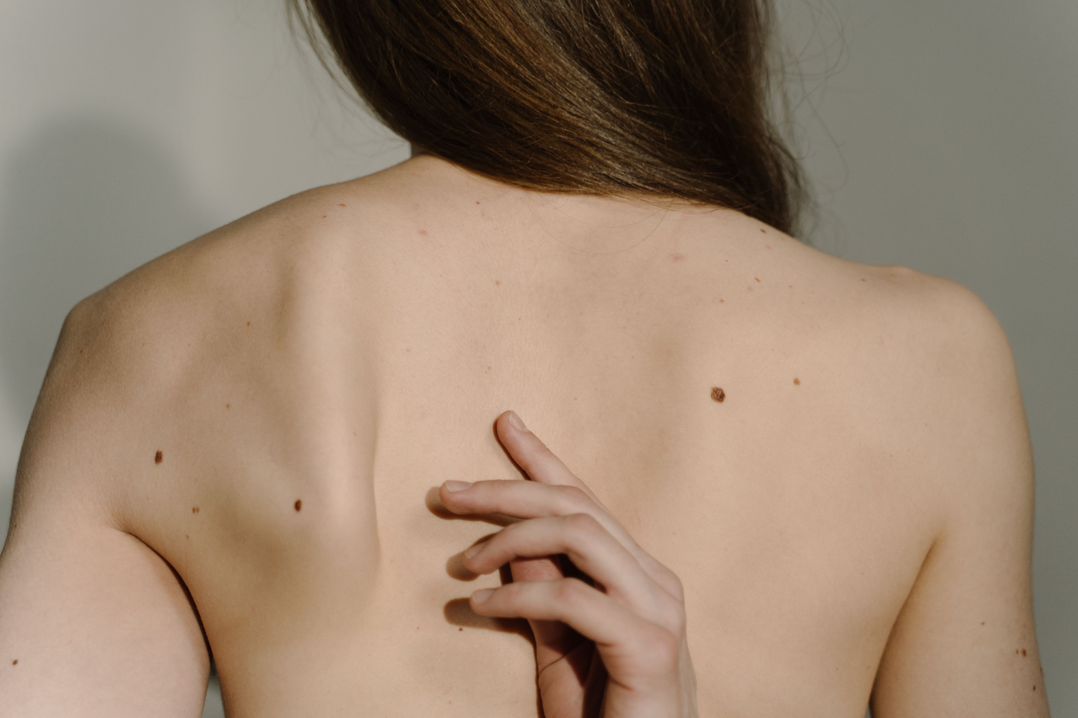 Así funciona la nueva vacuna de ARN contra el melanoma que abre una vía para tratar otros cánceres Así funciona la nueva vacuna de ARN contra el melanoma que abre una vía para tratar otros cánceres