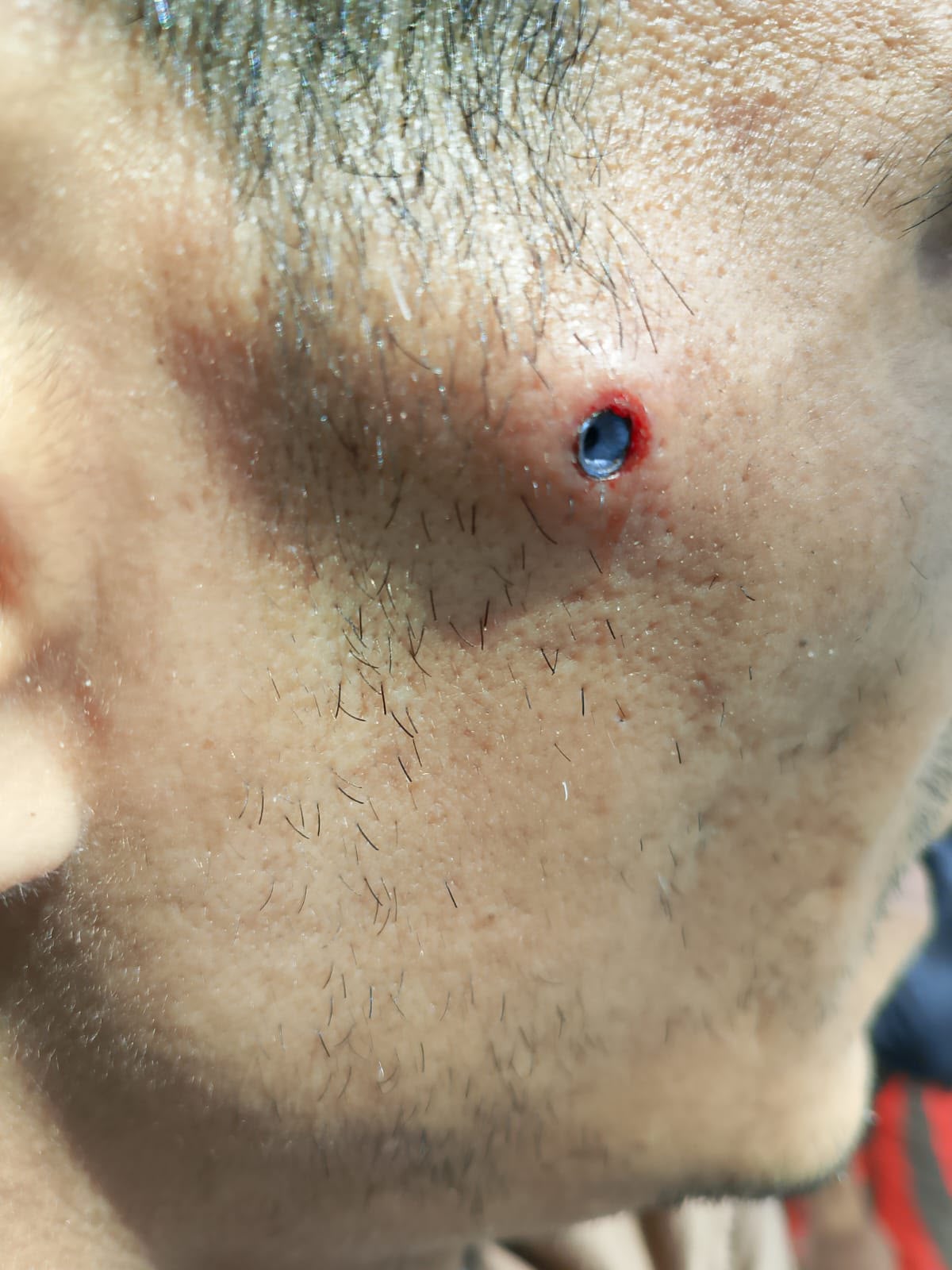 Denuncian la agresión a una persona migrante con un arma de aire comprimido en San Sebastián Denuncian la agresión a una persona migrante con un arma de aire comprimido en San Sebastián