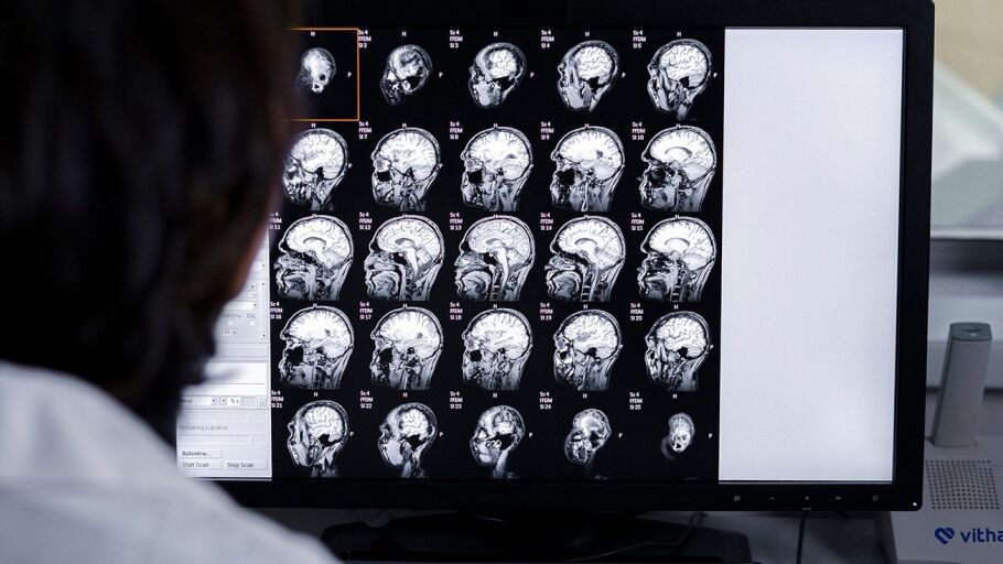 Cerca de 15.630 personas padecen alzh&eacute;imer en Granada: los hospitales avanzan en diagn&oacute;sticos m&aacute;s precisos