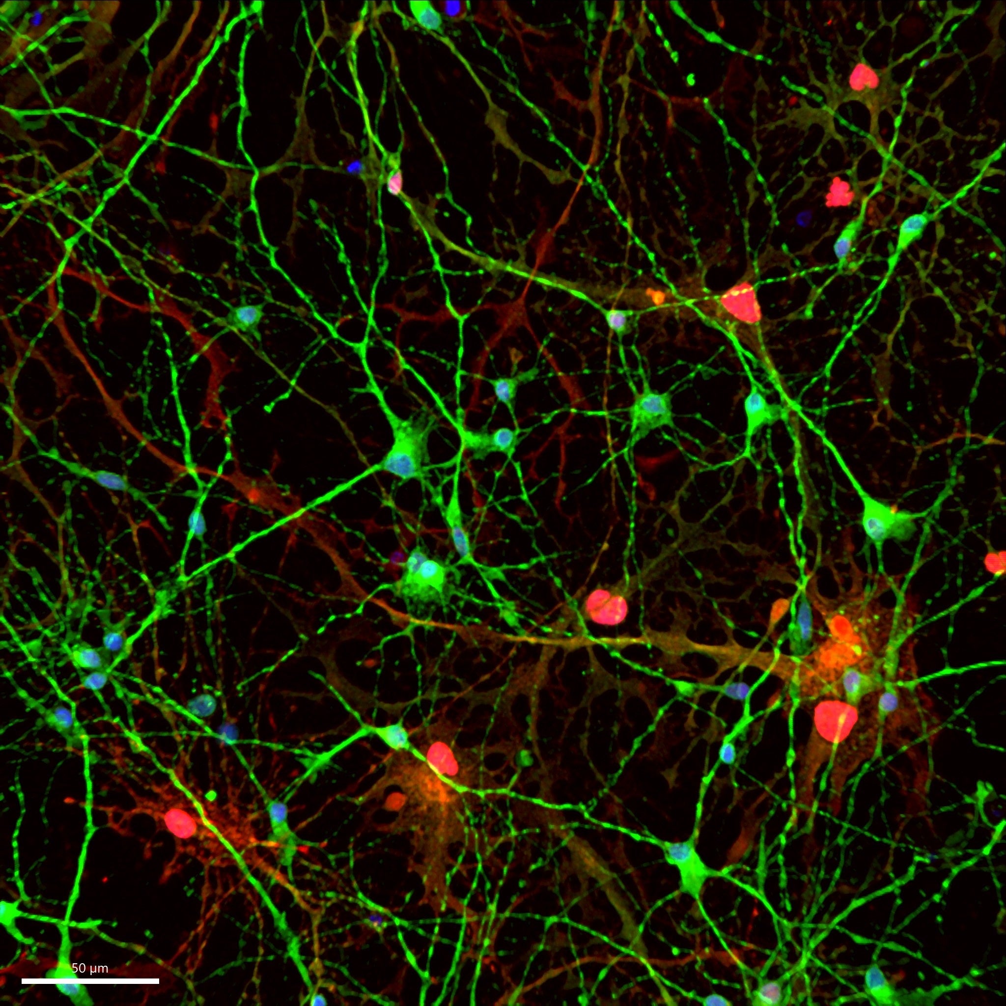 Científicos del Instituto de Neurociencias de la UMH de Elche identifica el aumento de una proteína en el cerebro y el líquido cefalorraquídeo de personas con alzhéimer Científicos del Instituto de Neurociencias de la UMH de Elche identifica el aumento de una proteína en el cerebro y el líquido cefalorraquídeo de personas con alzhéimer