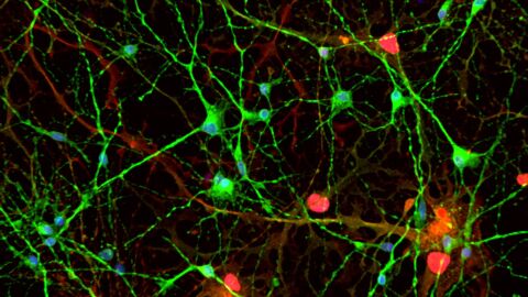 Imagen de un cultivo celular de c&eacute;lulas madre pluripotentes inducidas (iPSC). Las neuronas est&aacute;n marcadas en verde y los astrocitos, en rojo. 