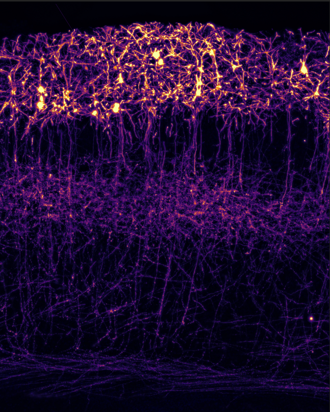 Un estudio del Instituto de Neurociencias de la UMH de Elche descubre que una proteína coordina cuándo y dónde se establecen las conexiones en el cerebro Un estudio del Instituto de Neurociencias de la UMH de Elche descubre que una proteína coordina cuándo y dónde se establecen las conexiones en el cerebro
