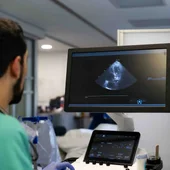 Las enfermedades cardiovasculares causan una de cada cuatro muertes en España, situándose como la segunda gran causa de mortalidad Las enfermedades cardiovasculares causan una de cada cuatro muertes en España, situándose como la segunda gran causa de mortalidad