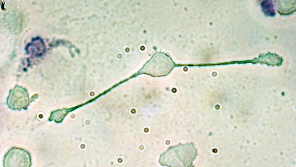 Un macròfag de ratolí formant patògens per engolir dues partícules