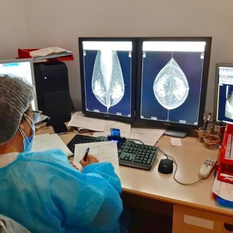 Mamografia en la red sanitaria publica valenciana 