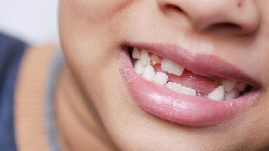 Ni&ntilde;o con dientes de leche