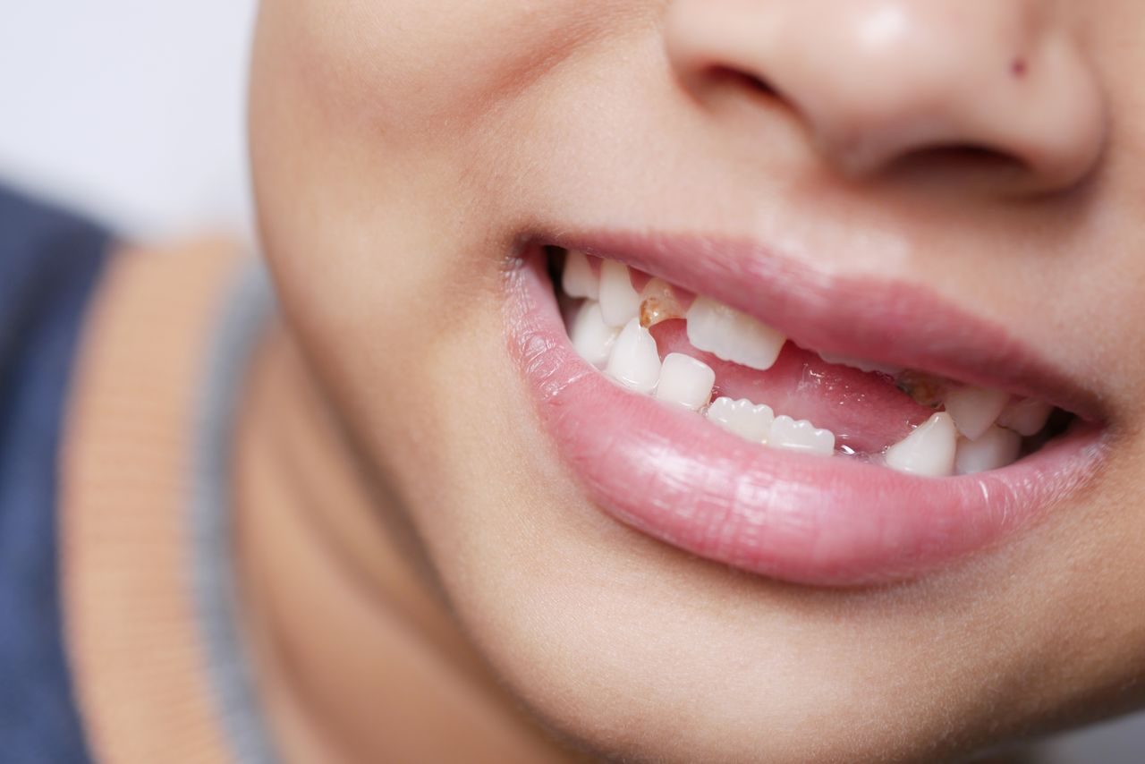 Mesa de redacción: ¿Guardas los dientes de leche de tus hijos? Mesa de redacción: ¿Guardas los dientes de leche de tus hijos?