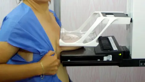 Mujer realizándose una mamografía Mujer realizándose una mamografía