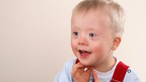 Ni&ntilde;o con s&iacute;ndrome de down