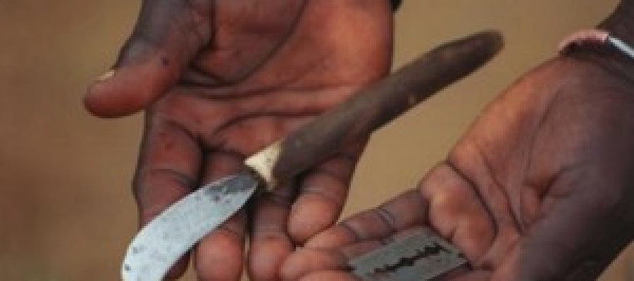 Cuchillas de afeitar, navajas o trozos de vidrio se emplean para realizar la ablación. Cuchillas de afeitar, navajas o trozos de vidrio se emplean para realizar la ablación.