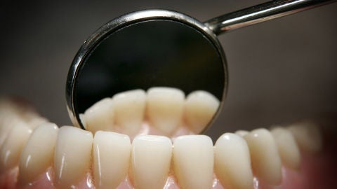 Cuida tu salud bucodental si no quieres tener lesiones