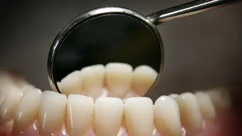 Cuida tu salud bucodental si no quieres tener lesiones Cuida tu salud bucodental si no quieres tener lesiones