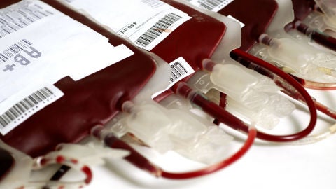 transfusi&oacute;n de sangre