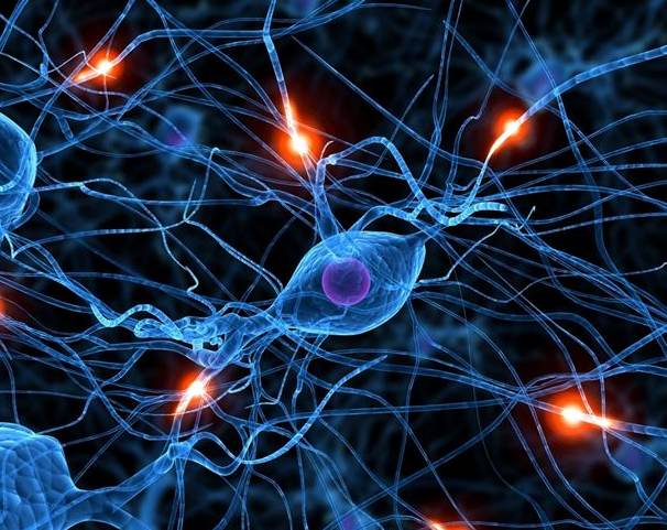 Identifican un tipo de demencia que se confunde con el Alzheimer Identifican un tipo de demencia que se confunde con el Alzheimer