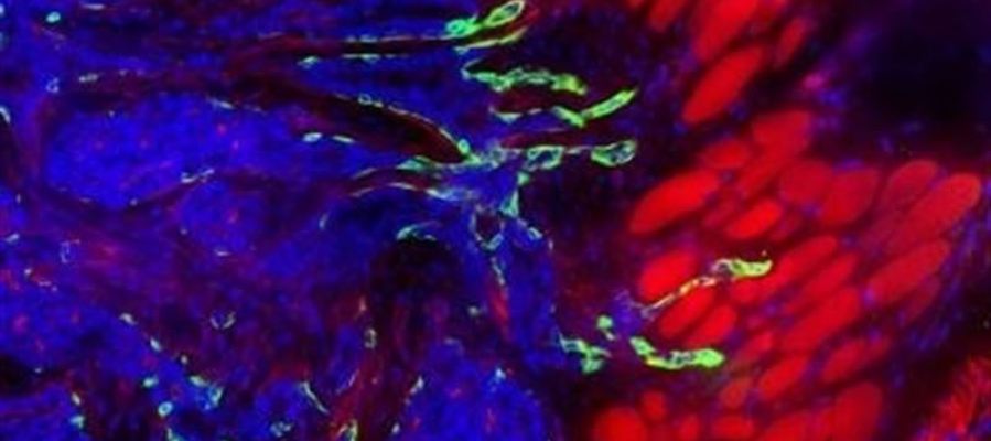 Una investigación presenta un atlas que detalla las proteínas vinculadas al cáncer Una investigación presenta un atlas que detalla las proteínas vinculadas al cáncer