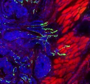 Una investigación presenta un atlas que detalla las proteínas vinculadas al cáncer Una investigación presenta un atlas que detalla las proteínas vinculadas al cáncer