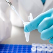 La biopsia líquida una nueva técnica para analizar la evolución del cáncer 