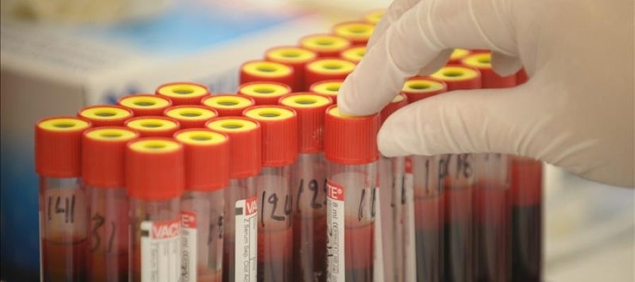 Muestras de sangre Muestras de sangre